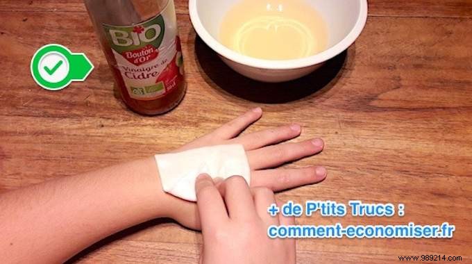 Heal Minor Wounds Naturally: Disinfect with Apple Cider Vinegar – No Antiseptic Needed