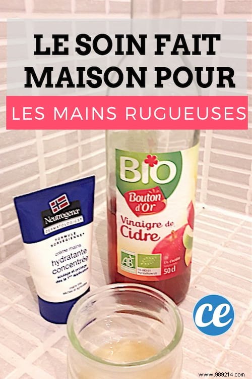 Revive Dry, Cracked Hands: A Proven Grandmother s Remedy with Apple Cider Vinegar