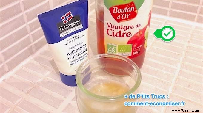 Revive Dry, Cracked Hands: A Proven Grandmother s Remedy with Apple Cider Vinegar