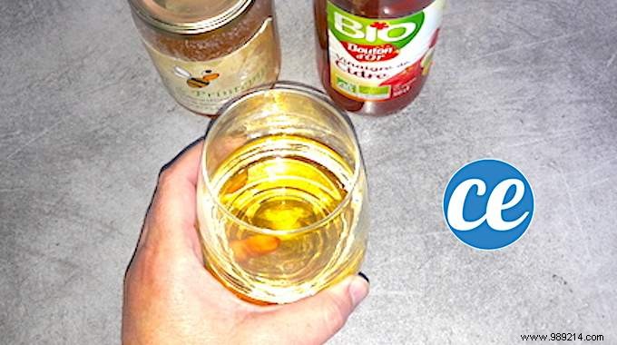 Natural Apple Cider Vinegar and Honey Remedy for Morning Sickness Relief