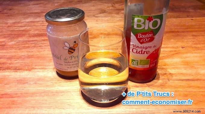 Natural Apple Cider Vinegar and Honey Remedy to Prevent Gout Attacks