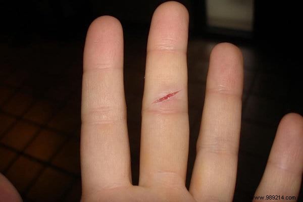 Lavender Essential Oil: 14 Proven Uses for Stress Relief, Skin Healing, and More