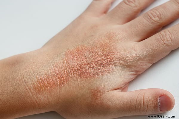 Lavender Essential Oil: 14 Proven Uses for Stress Relief, Skin Healing, and More