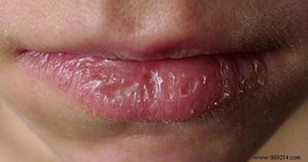 Lavender Essential Oil: 14 Proven Uses for Stress Relief, Skin Healing, and More