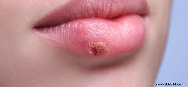 Lavender Essential Oil: 14 Proven Uses for Stress Relief, Skin Healing, and More