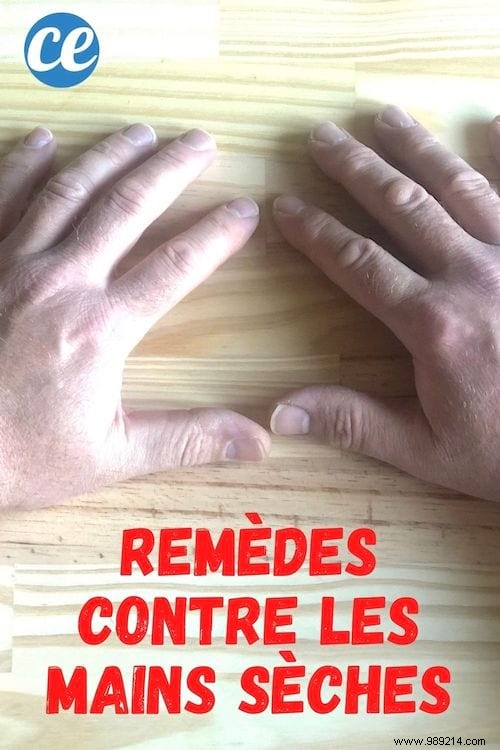 6 Time-Tested Grandmother s Remedies for Dry, Cracked Hands