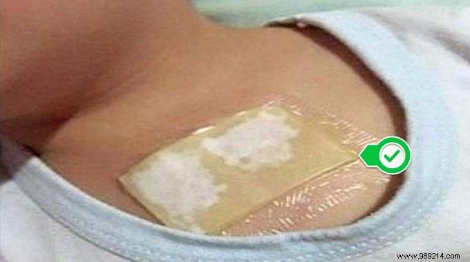 Natural Cough Relief: Honey and Coconut Oil Chest Poultice – A Time-Tested Remedy