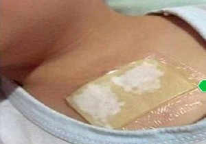 Natural Cough Relief: Honey and Coconut Oil Chest Poultice – A Time-Tested Remedy