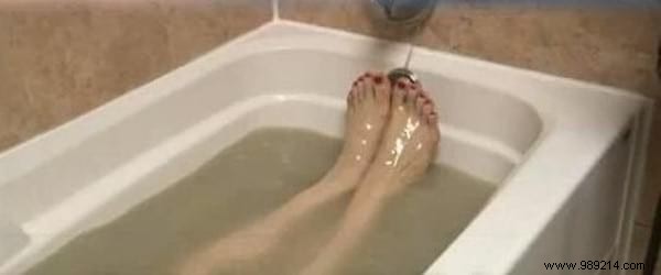 4 Proven White Clay Remedies for Soothing Psoriasis