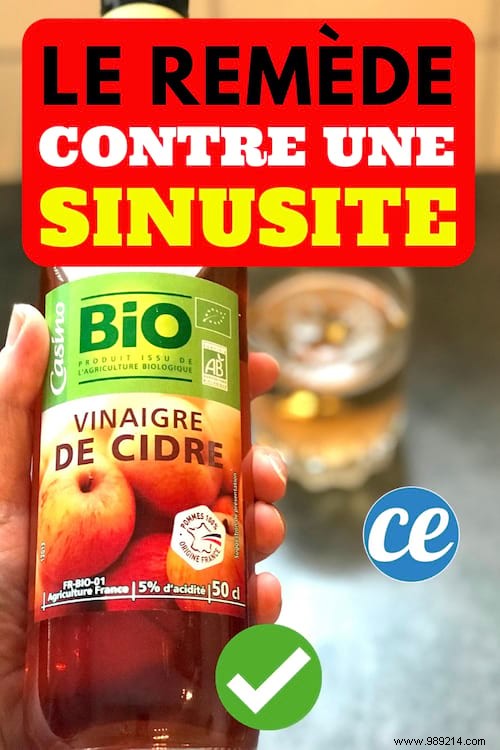 Pharmacist s Trusted Natural Remedy: Relieve Sinusitis Fast with Apple Cider Vinegar