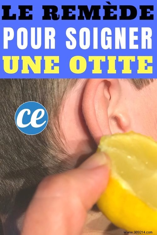 Time-Tested Lemon Juice Remedy for Ear Infection Relief – No Medication Needed