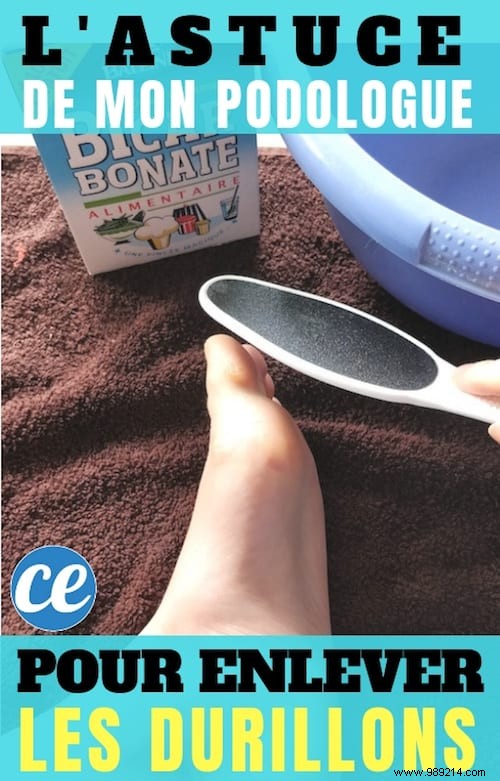 Podiatrist-Recommended Home Remedy for Foot Calluses: Baking Soda Soak