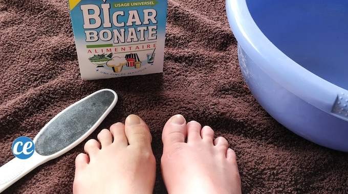 Podiatrist-Recommended Home Remedy for Foot Calluses: Baking Soda Soak