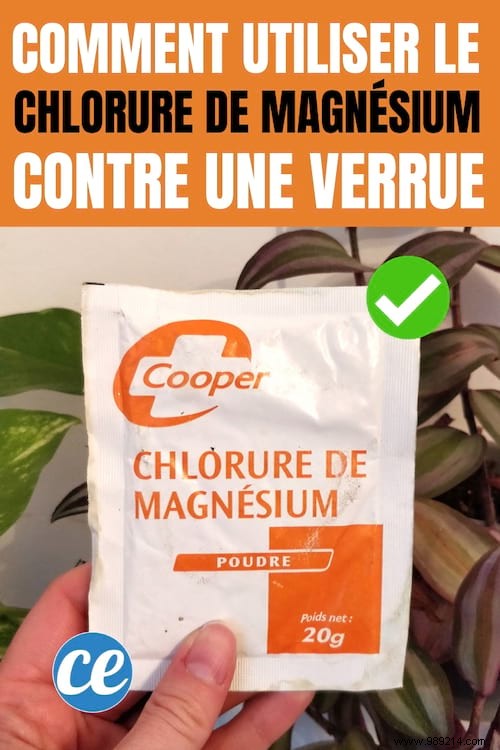 Painless Wart Removal: Effective Magnesium Chloride Treatments