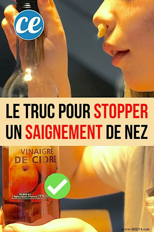 Stop Nosebleeds Fast: A Pharmacist s Proven Apple Cider Vinegar Remedy