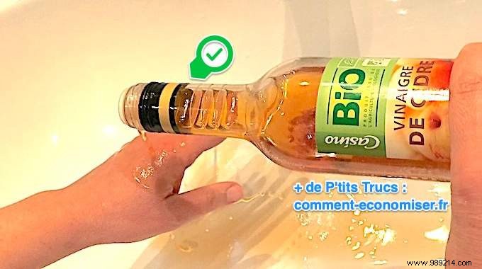 Nurse-Approved Remedy: Relieve Minor Burns and Prevent Blisters with This Simple Trick