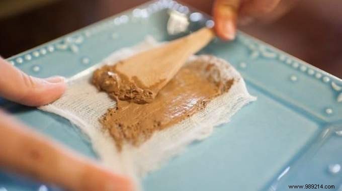 Relieve Bronchitis Symptoms Quickly with Traditional Green Clay Poultices