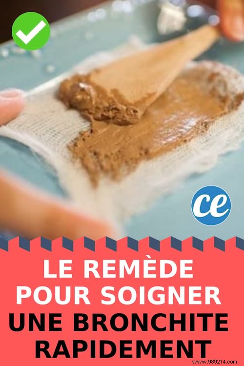 Relieve Bronchitis Symptoms Quickly with Traditional Green Clay Poultices