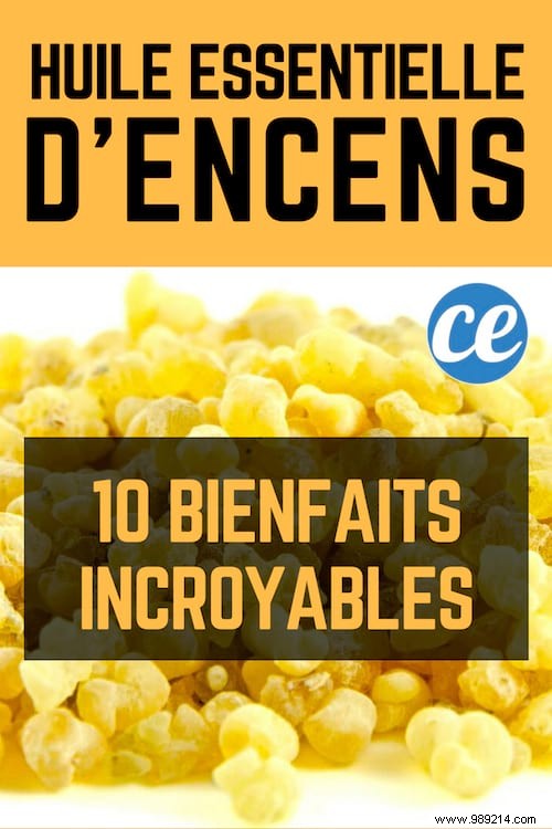 10 Science-Backed Benefits of Frankincense Essential Oil