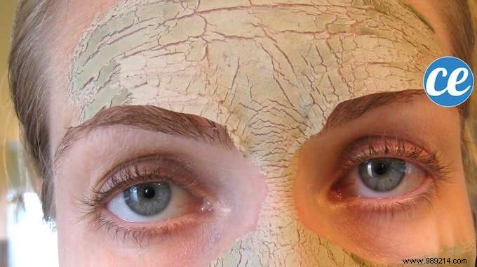 Proven Natural Green Clay Remedy for Fast Sinusitis Relief