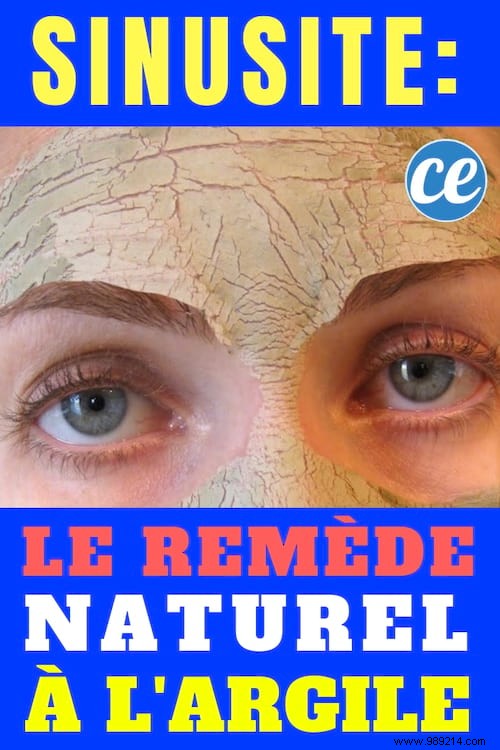 Proven Natural Green Clay Remedy for Fast Sinusitis Relief