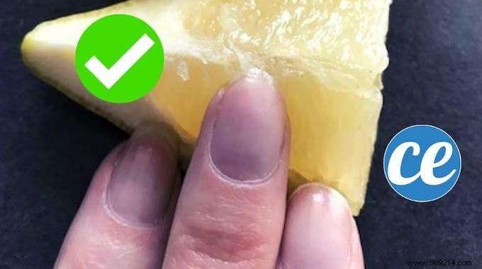 How to Whiten Yellowed Nails Naturally: Lemon s Proven, Budget-Friendly Trick