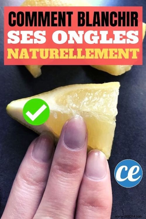 How to Whiten Yellowed Nails Naturally: Lemon s Proven, Budget-Friendly Trick