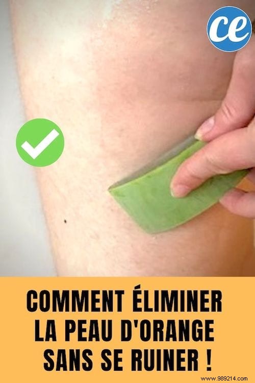 Grandma s Time-Tested Remedy: Smooth Orange Peel Skin Naturally and Affordably