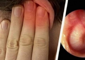 Prevent Swimmer s Ear Effectively: Grandma s Proven Vinegar-Alcohol Remedy