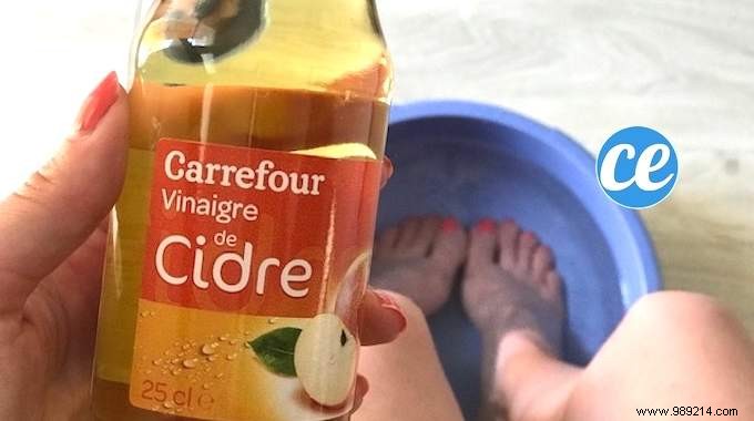 Grandma s Proven Vinegar Foot Soak for Instant Sore Feet Relief