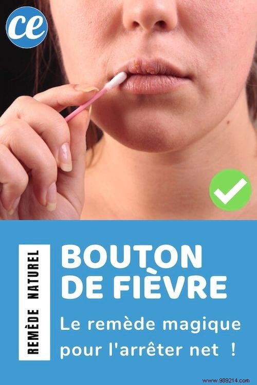 Stop Cold Sores on Your Lips Fast: The Apple Cider Vinegar Remedy