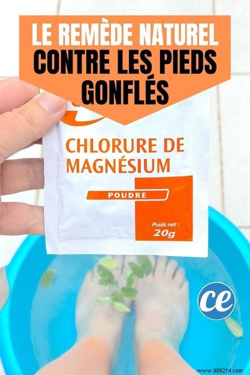 Swollen Feet from Summer Heat? This Proven Magnesium Chloride Foot Soak Provides Fast Relief