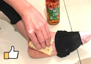 Grandma s Proven Remedy: Banish Foot Corns and Calluses Overnight Naturally