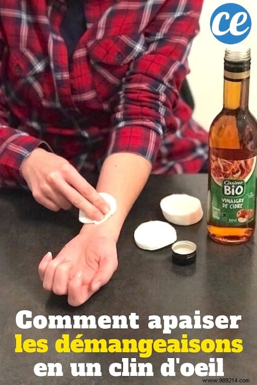 Quick Itchy Skin Relief: A Time-Tested Vinegar Remedy