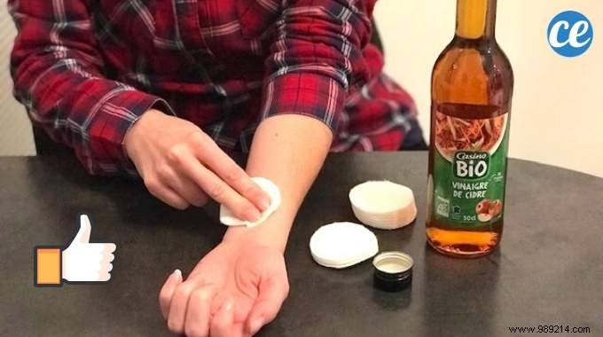 Quick Itchy Skin Relief: A Time-Tested Vinegar Remedy