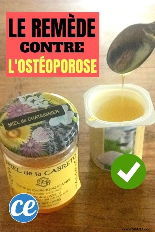 Supporting Bone Health Naturally: Honey as a Sugar Alternative for Women Over 50