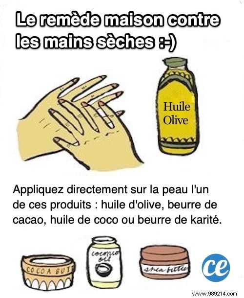 Heal Dry, Chapped Winter Hands Naturally with Olive Oil: A Proven Remedy