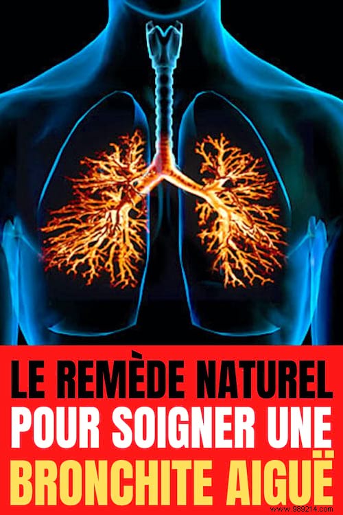 Natural Essential Oil Inhalation for Acute Bronchitis Relief
