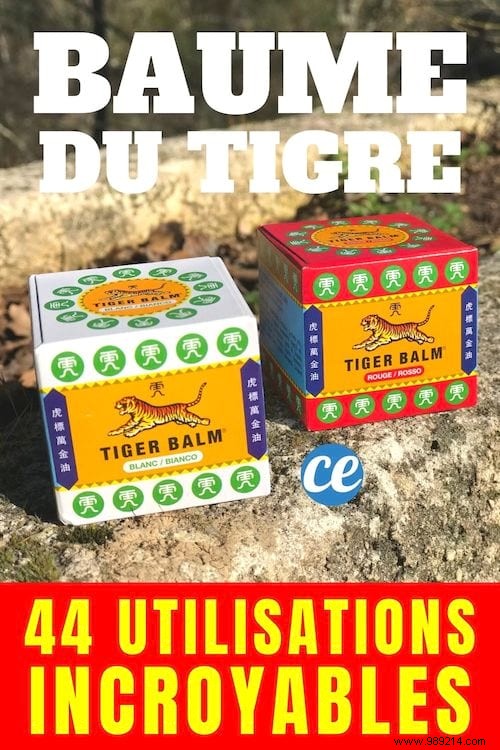 44 Time-Tested Uses for Tiger Balm: Health, Beauty, and Household Remedies Rooted in Tradition