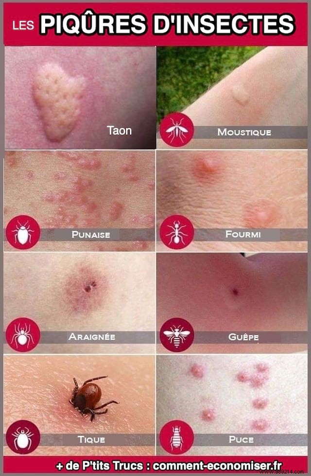 How to Identify Insect Bites: Simple Photo Guide to Common Culprits