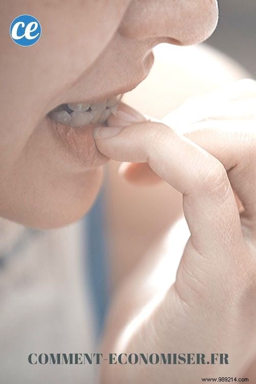 6 Proven Tips to Stop Nail Biting for Good: Backed by Experts
