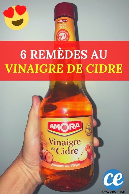 6 Proven Apple Cider Vinegar Remedies for Everyday Minor Ailments