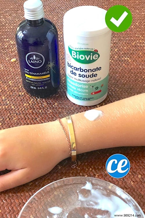 Relieve Mosquito Bite Itch Fast: Grandma s Baking Soda and Witch Hazel Paste Remedy