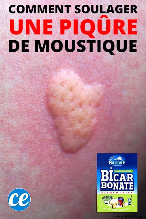 Soothe Mosquito Bites Fast: Baking Soda Paste Relief in Just 1 Minute