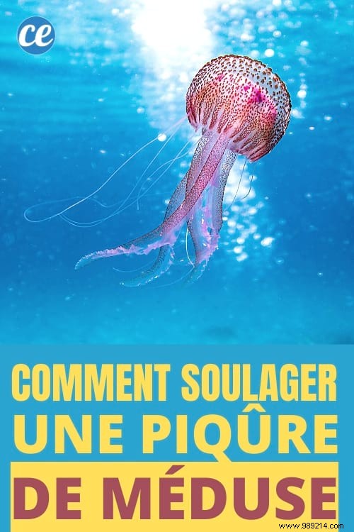 How to Instantly Relieve Jellyfish Sting Pain: Proven Vinegar Method