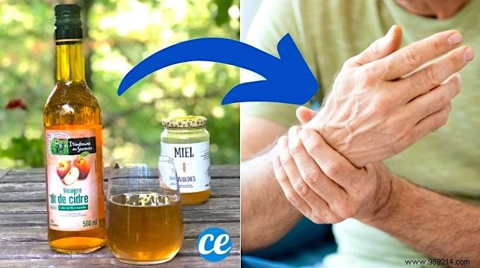3 Time-Tested Apple Cider Vinegar Remedies for Rheumatism, Gout, and Osteoporosis