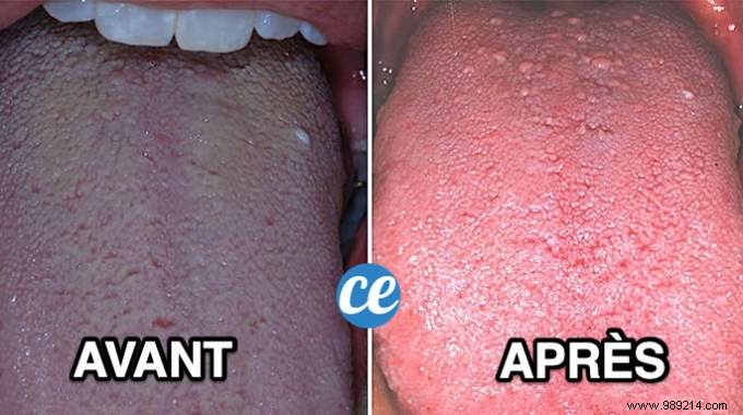 6 Proven Tips to Eliminate Bad Breath for Good