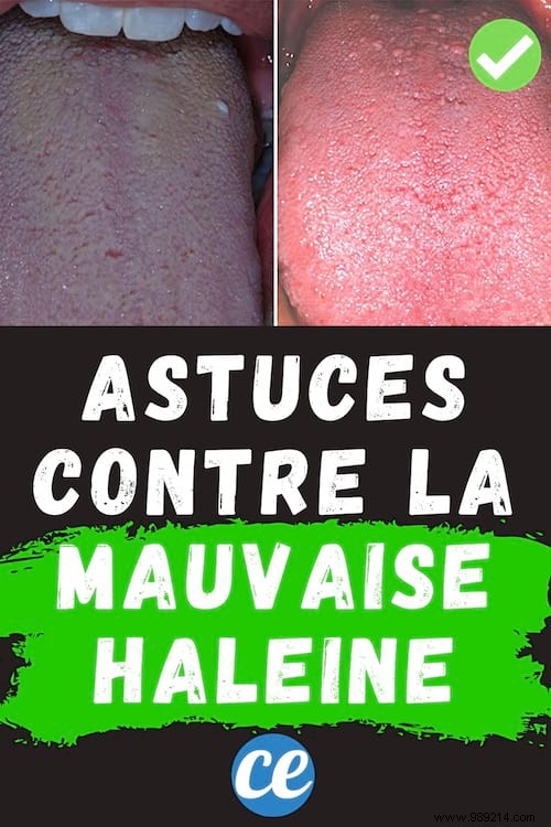 6 Proven Tips to Eliminate Bad Breath for Good