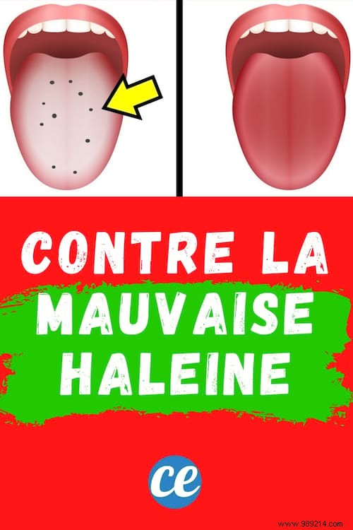 6 Proven Tips to Eliminate Bad Breath for Good