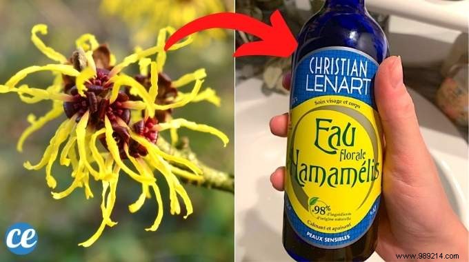 17 Proven Benefits of Witch Hazel Water for Skin, Hair, Circulation, and Wellness